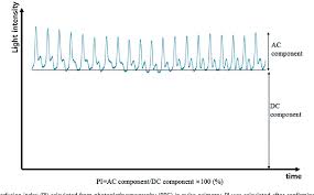 figure 2 from oxygen saturation and perfusion index from