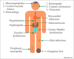 How do you feel about technology? Diabetes Mellitus Part 2 Diabetes Mellitus Diagnosis And Management Labpedia Net