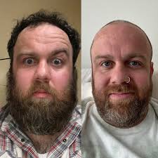 3 years sober my dudes! I thought that a life without drugs and alcohol  wouldn't be a life worth living, but I've learned otherwise. This recovery  thing is the shit. I have