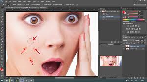 Ini juga bisa muncul di pipi, hidung, dahi, dan dada. Tutorial Menghilangkan Jerawat Di Photoshop Sukainnet