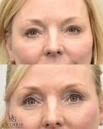 Guthrie Facial Plastic Surgery