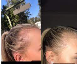 Whether in the form of a fizzy drink or flavored lozenges, cold and flu preventative supplements almost always highlight vitamin c as one of their key ingredients. Hair Energy Jshealth Vitamins Vitamins For Hair Growth Vitamins For Energy Growing Healthy Hair