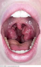 Streptokokkovaya Infekciya Poleznye Stati Na Kupibonus A Takzhe Kupony Skidki Na Uslugi V Moskve Moskva Kupibonus Ru