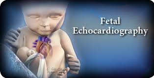 Fetal Echocardiography Pegasus Lectures