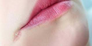 заеды в уголках рта причины и лечение у взрослых Https Xn 7sbbmwdimhtcb5aabbrd6w Xn P1ai Raznoe Prichiny Poyavleniya Zaedov V Ugolkax Gub U Vzroslyx Chem Lechit Zaedy V Ugolkax Rta Bystro U Vzroslogo I Detej Html