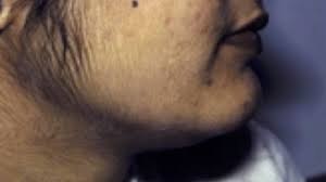 The sikh woman who won't remove her facial hair for religious reasons. What Do I With My Excess Facial Hair