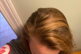 Switch to baking soda for hair and get beautiful and lustrous strands in no time. Holy Farts It Worked First Time Skeptic With Chronically Greasy Hair Simple Baking Soda Scrub And Acv Rinse And My Greasy Hair Looks So Clean No Grease Nopoo