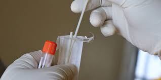 Lateral flow tests are immunoassays for detecting food pathogens with the ultimate convenience. What Is Lateral Flow Testing And How Could It Be Deployed Against Coronavirus Gavi The Vaccine Alliance