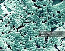 Image result for Group D Streptococcus