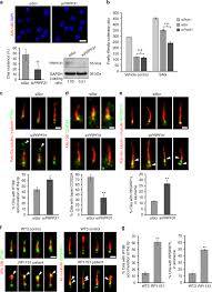 Find the perfect furniture & decor to reflect your style, inspire your space, and make home the place you love most. Disrupted Alternative Splicing For Genes Implicated In Splicing And Ciliogenesis Causes Prpf31 Retinitis Pigmentosa Nature Communications
