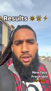 Fellas, it’s time to level up your self care game. , Just got a Bro-Facial  at @hyperchargehealthskindeep , Go see @natthemnesti she will have you  feeling reborn and confident as ever!, Here’s what we ...