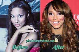 She is younger and vibrant but natural. Tamar Braxton Plastic Surgery Before And After