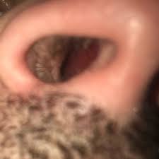 Die ursachen für eine nasenerkrankung sollten in jedem fall aufgeklärt werden. Meine Nase Ist Seit Monaten Wenn Man Mit Einem Tempo In Die Nase Rein Geht Blutig Gesundheit Und Medizin