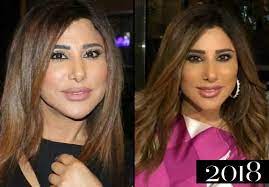 صور صادمه لفنانات العرب قبل وبعد عمليات التجميل نجوى احلام نانسي اليسا ونجوم خليجياااات. Ø¨Ø§Ù„ØµÙˆØ± Ù…Ø±Ø§Ø­Ù„ ØªØ·Ùˆ Ø± Ø¬Ù…Ø§Ù„ Ù†Ø¬ÙˆÙ‰ ÙƒØ±Ù… Ø¹Ø¨Ø± Ø§Ù„Ø³Ù†ÙŠÙ†