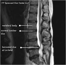 Pin On Mri