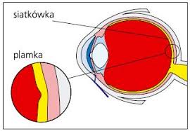 Zapalenie siatkówki oka powodowane jest przez wirusy, bakterie czy pasożyty atakujące także inne. Makulopatia Okulistyka Medycyna Praktyczna Dla Pacjentow