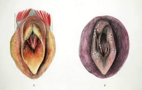 May 21, 2021 · treatment of laryngeal paralysis in dogs. Laryngeal Hemiplegia In Horses Respiratory System Veterinary Manual