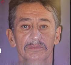 Esta muerto en Quindío