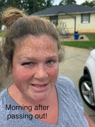 Fundraiser by Amy Lothridge : Living in Constant Pain .