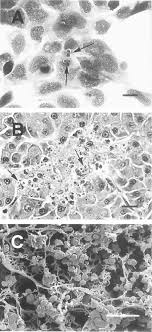Pt aqua golden mississippi didirikan sebagai pioner perusahaan air minum mineral pertama di indonesia. Observations On The Life Stages Of Sphaerothecum Destruens N G N Sp A Mesomycetozoean Fish Pathogen Formally Referred To As The Rosette Agent Arkush 2003 Journal Of Eukaryotic Microbiology Wiley Online Library