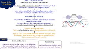 Image result for Cheyne-Stokes Respiration