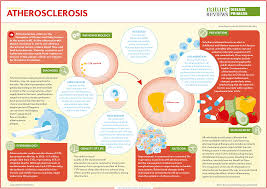 In reality, getting your first health insurance plan does not have to be daunting. Atherosclerosis Nature Reviews Disease Primers