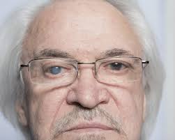 We did not find results for: Does Cataract Surgery Hurt Family Eye Physicians