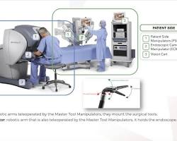 Artificial intelligence for surgery invention