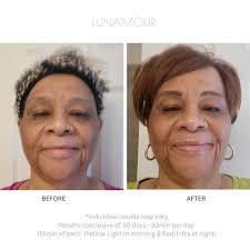 AuraLux Advanced+ Technology Anti-Aging LED & Infrared Face Mask