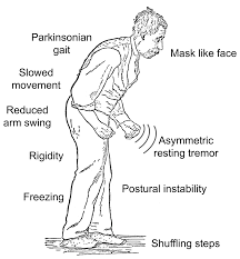 In everything we do, we build on the energy, experience and. Parkinson S Four Unusual Signs You May Be At Risk
