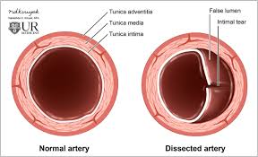 Arteria carotis interna) is located in the inner side of the neck in contrast to the external carotid artery. Pathology Of The Carotid Space Insights Into Imaging Full Text