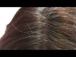 Sac Boyasi Degil Tamamen Dogal Bu Su Ile Beyaz Saclarinizdan Tamamen Kurtulacaksiniz Evet Sac Boyasi Yok Sadece B Hair Hacks Homemade Skin Care Dye My Hair