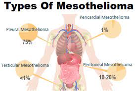 Check spelling or type a new query. Mesothelioma Cancer Causes Symptoms Diagnosis Prognosis Treatment