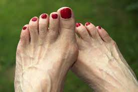 We did not find results for: Why Are My Toes Red Causes Other Symptoms And Treatments