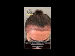 Thick scaling, red irritated lesions on the scalp are easily diagnosed by a dermatologist and most often they are a form of psoriasis, said mcmichael. Genetic Female Hair Loss Dr Cagatay Sezgin Dubai