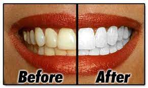 You can go for any brand of toothpaste but make sure that it. Pin On Diy Cratfs
