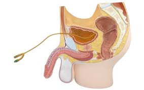 Image result for Urethral Catheterization