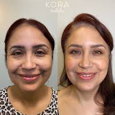 Botox Injections Near Me in Scottsdale, AZ