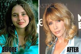 The wrong man trailer 1993 director: Rosanna Arquette Plastic Surgery Before And After
