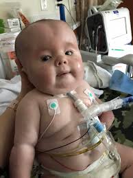 Jesse's fever persists at 103 degrees