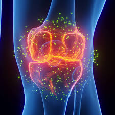 Educational image placeholder: synovial inflammation in rheumatoid arthritis