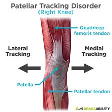 Image result for Patella Tracking Assessment