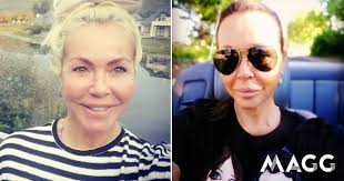 Elsa Raposo partilha fotos onde parece ter feito intervenções estéticas no  rosto