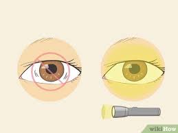 How To Tell If Someone Is Dead: 10 Steps (With Pictures) - Wikihow