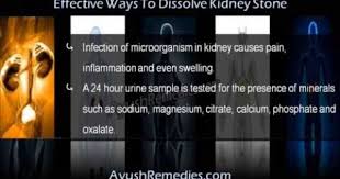 This Video Describes About The Most Effective Ways To Dissolve Kidney Stone At Home You Can Find More Detail About Kid Clear Caps Kidney Stones Kidney Capsule