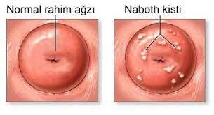 Pin On Obat Herbal