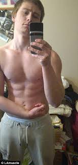 Repeated radiological evaluations were performed in 11 (47.8%) of the patients. Boy Who Used To Survive On Just A Banana And Cereal Bar A Day Beats Anorexia To Become Personal Trainer And Model Daily Mail Online