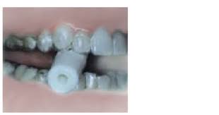 Invisalign Aligner Chewies Pack Of 20 In 2020 Invisalign Invisalign Aligners Invisalign Braces