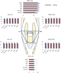 Image result for Elson Extensor Tendon Test