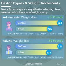 4 charts gastric byp effectiveness